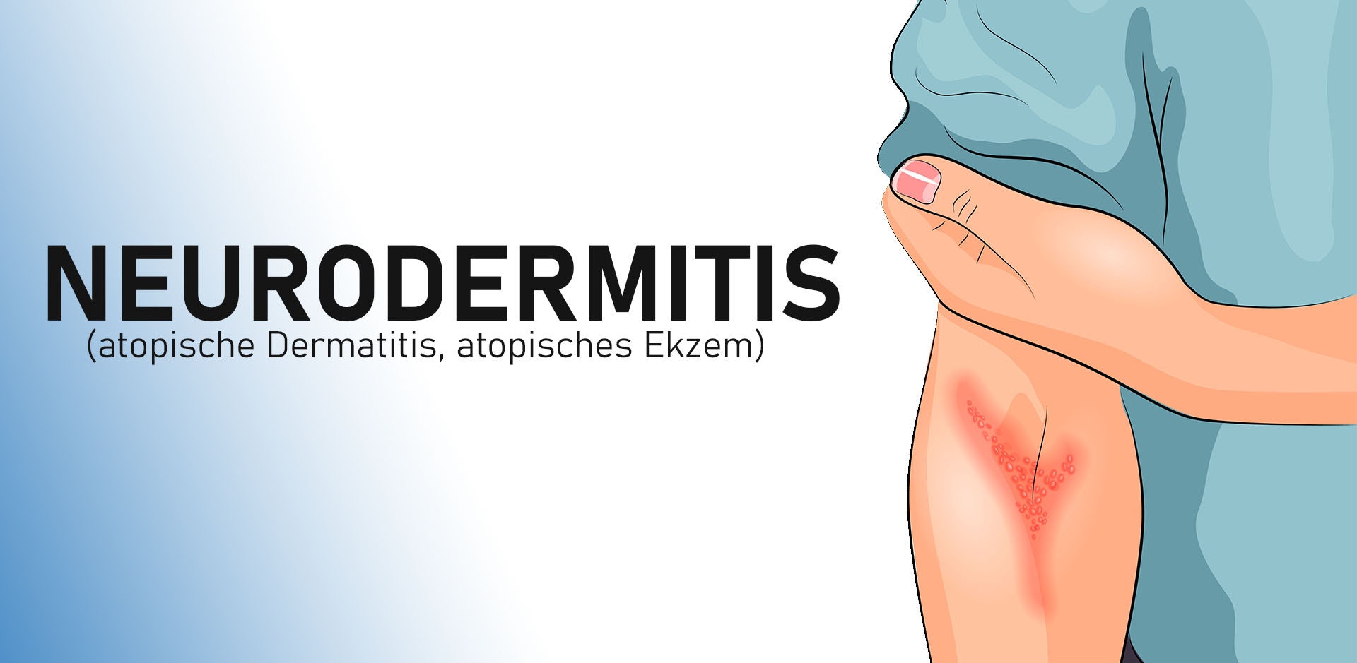 Neurodermitis Headerbild